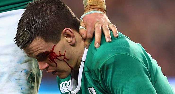 2015 Six Nations: Oh the brutality!